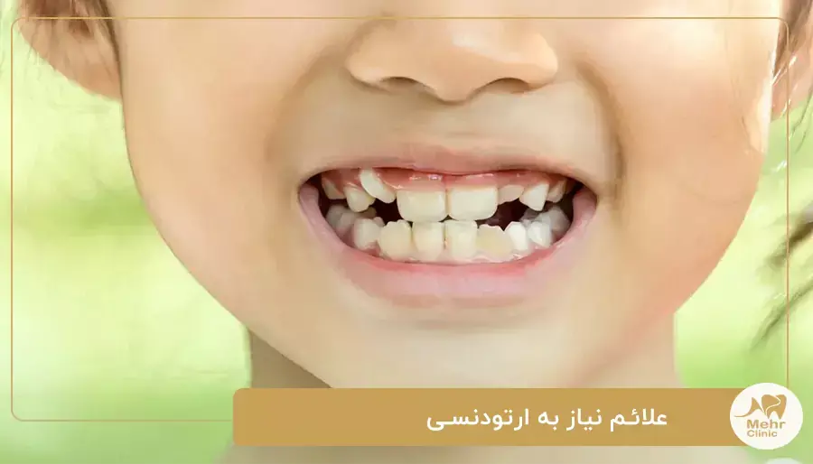 علائم نیاز به ارتودنسی