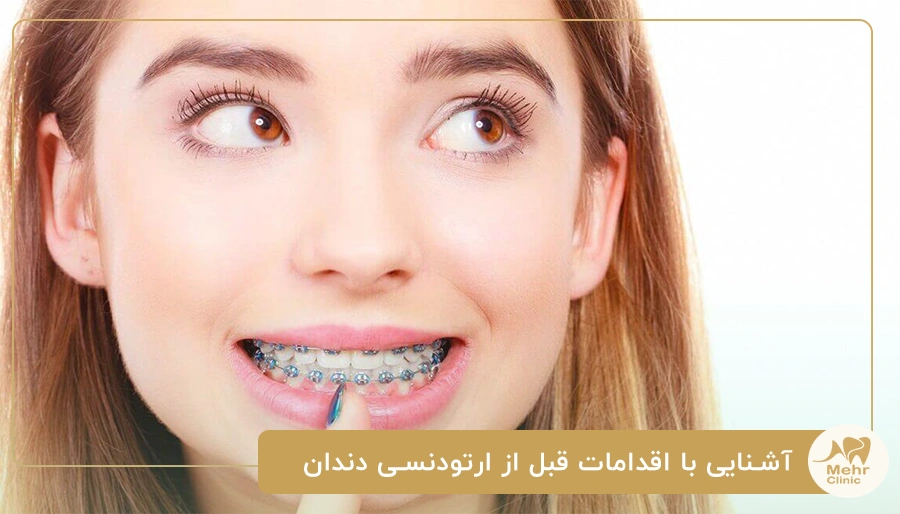 آشنایی با اقدامات قبل از ارتودنسی دندان