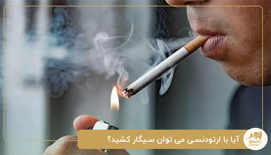آیا با ارتودنسی می توان سیگار کشید؟