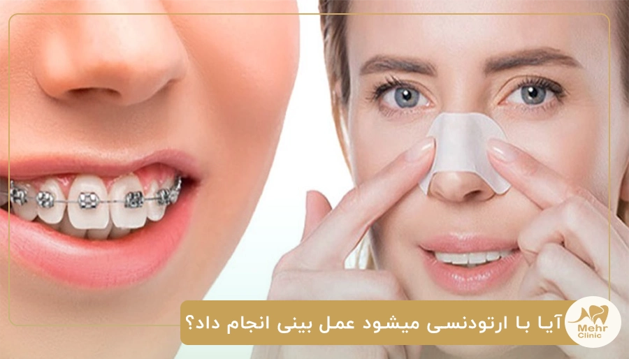 آیا با ارتودنسی میشود عمل بینی انجام داد؟