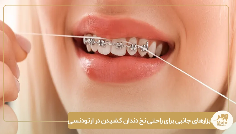 ابزارهای جانبی برای راحتی نخ دندان کشیدن در ارتودنسی