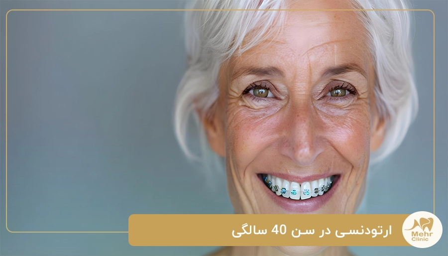 ارتودنسی در سن 40 سالگی