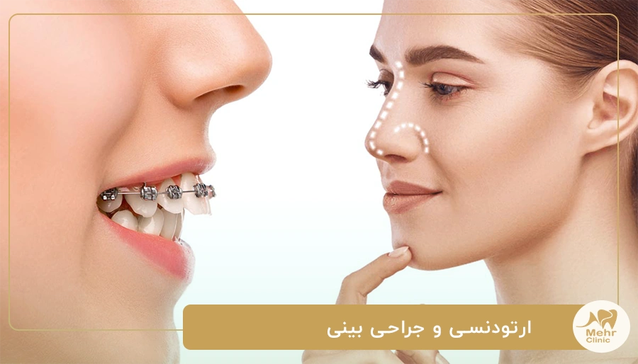 ارتودنسی و جراحی بینی