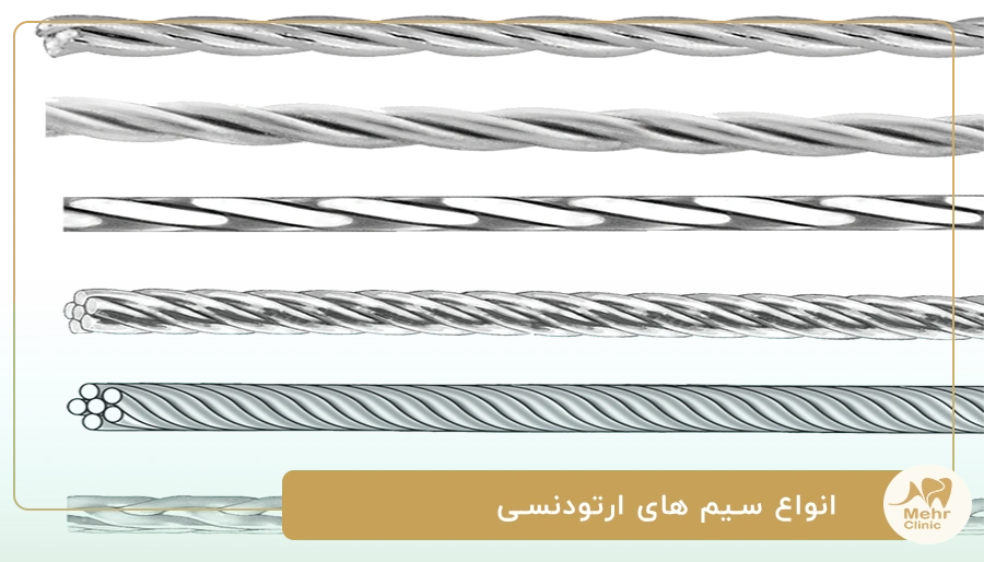 انواع سیم های ارتودنسی