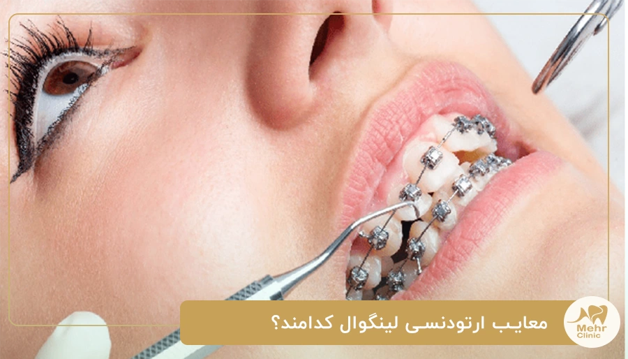 رژیم غذایی مناسب حین درمان ارتودنسی