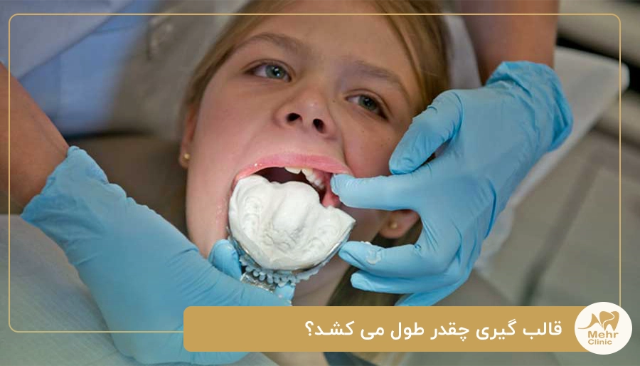 قالب گیری چقدر طول می کشد؟