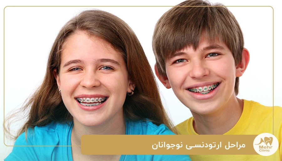 مراحل ارتودنسی نوجوانان