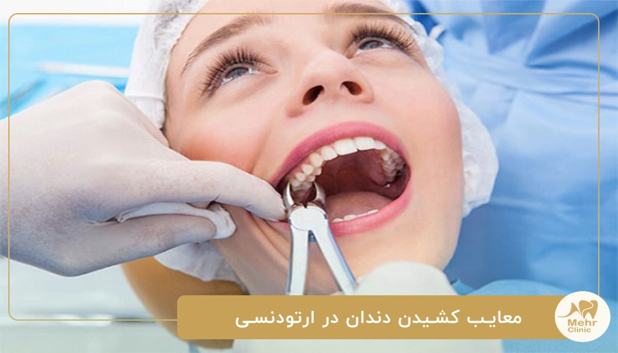 معایب کشیدن دندان در ارتودنسی