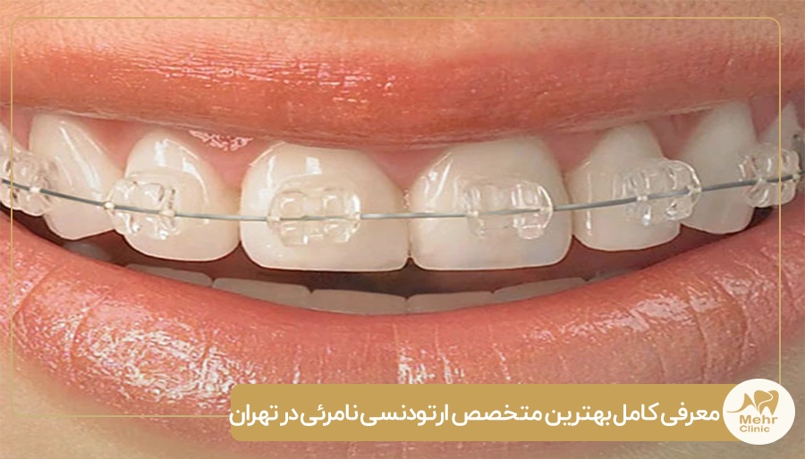 متخصص ارتودنسی نامرئی در تهران