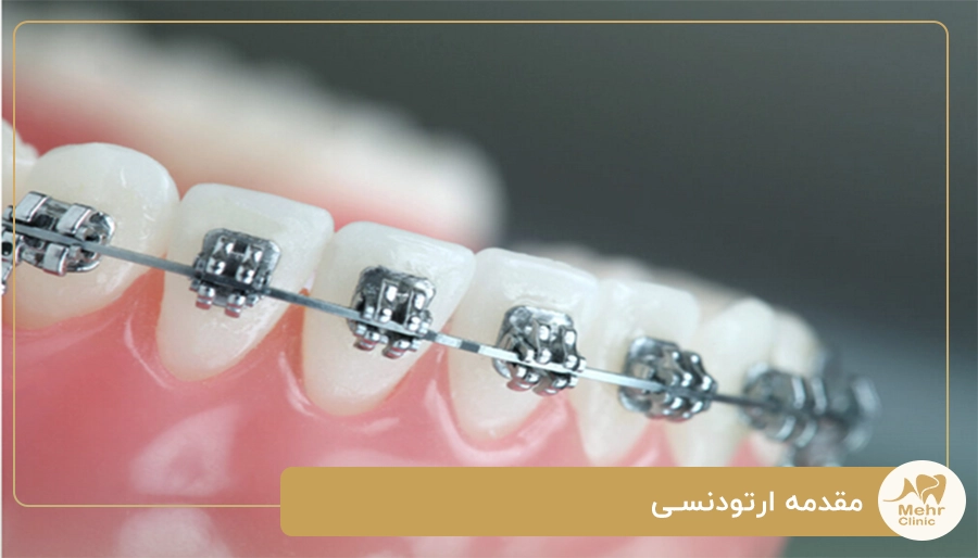 مقدمه ارتودنسی