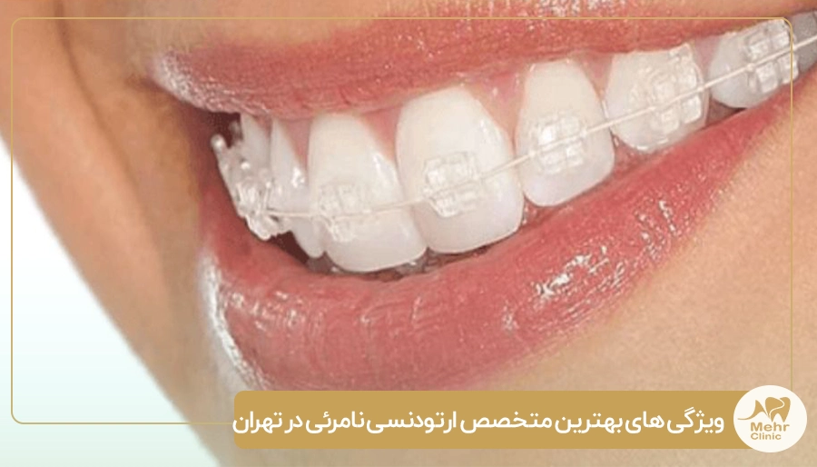 ویژگی های بهترین متخصص ارتودنسی نامرئی در تهران
