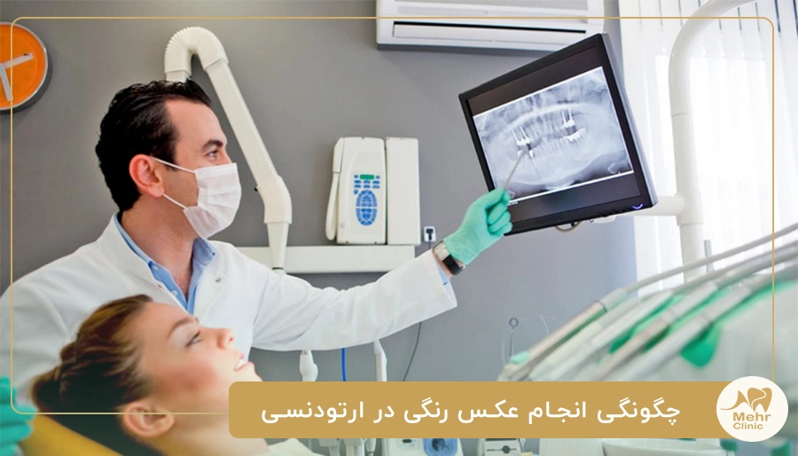 چگونگی انجام عکس رنگی در ارتودنسی