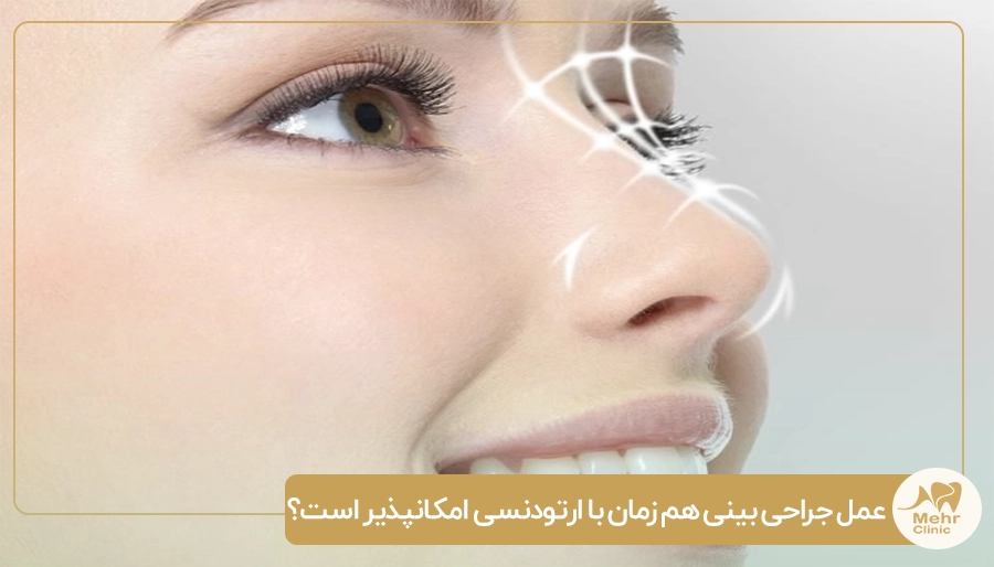 عمل جراحی بینی هم زمان با ارتودنسی امکانپذیر است؟